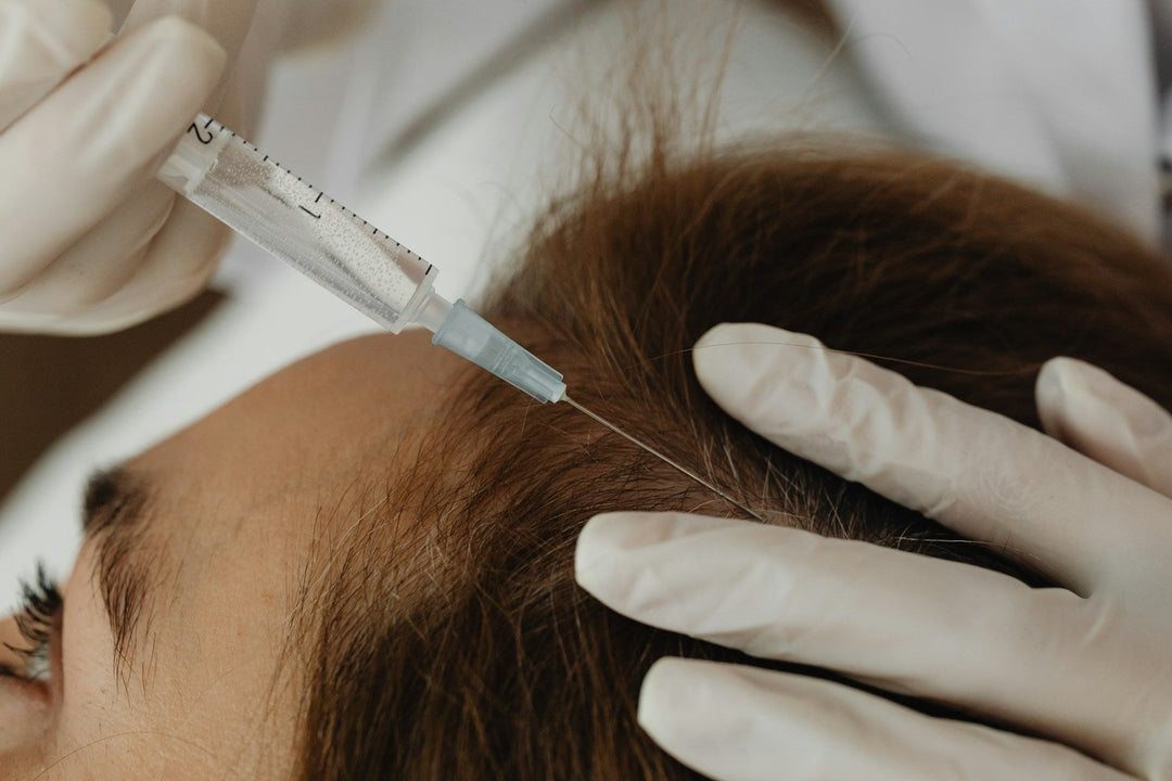 Scalp Treatment