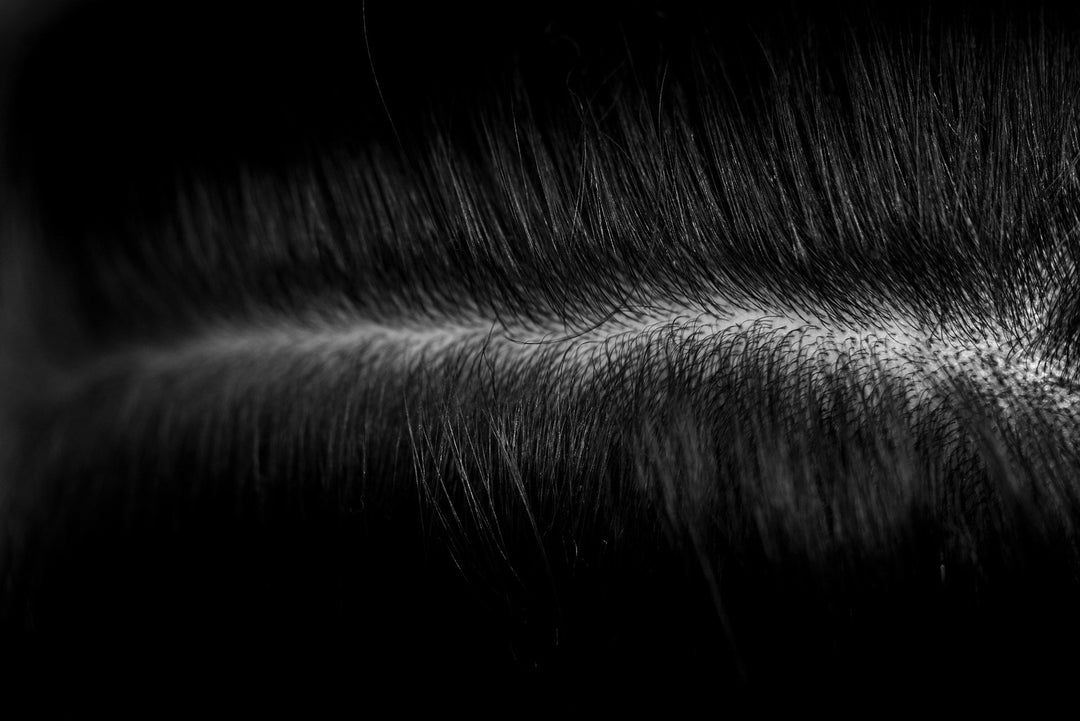 Scalp Reset
