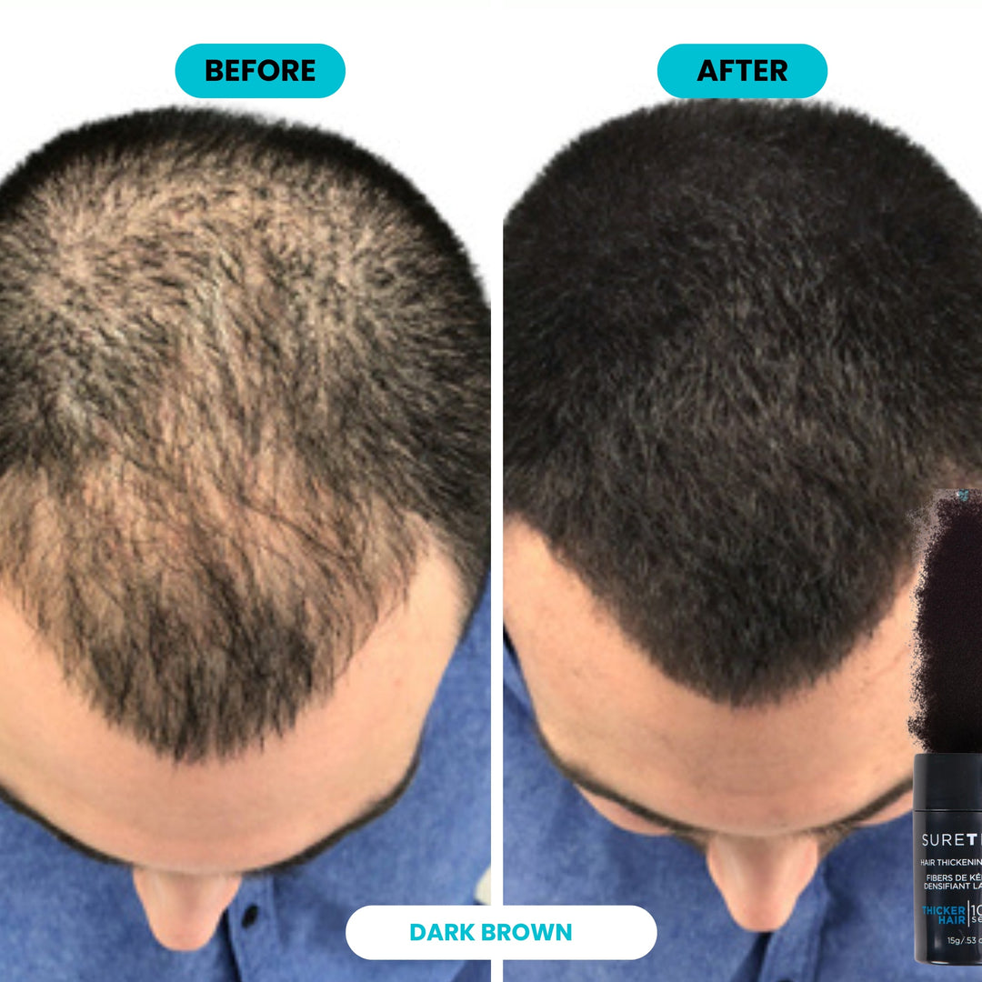 SureThik Hair Thickening Fibers - before and after on a thinning crown, Dark Brown
