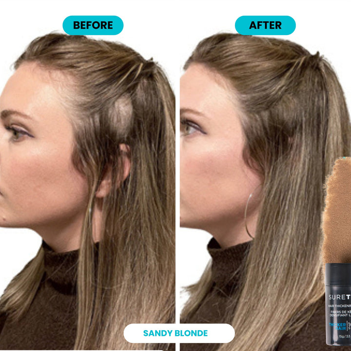 SureThik Hair Thickening Fibers - before and after on a widening part, Sandy Blonde