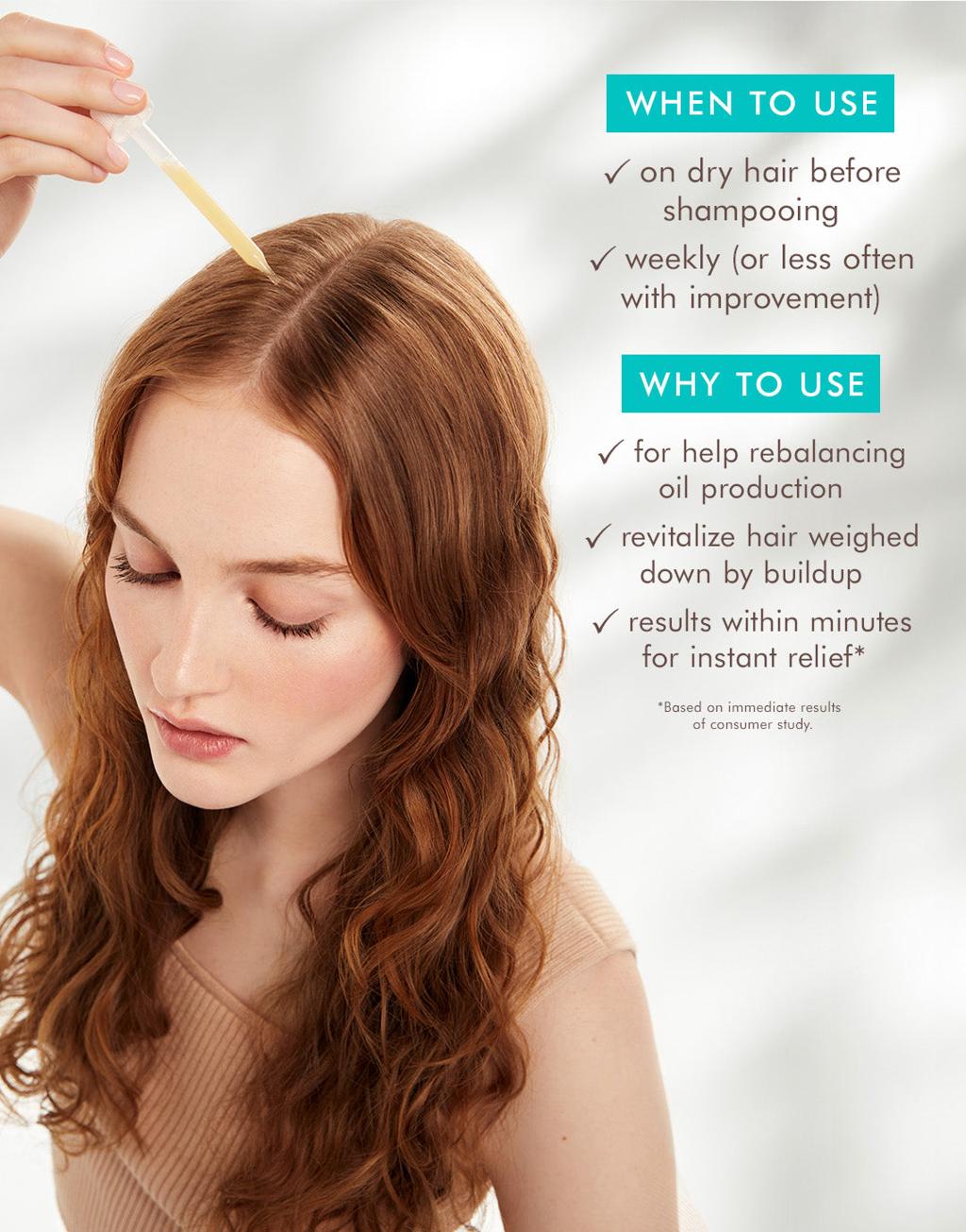 Moroccan Oil-OIL NO MORE Scalp Treatment