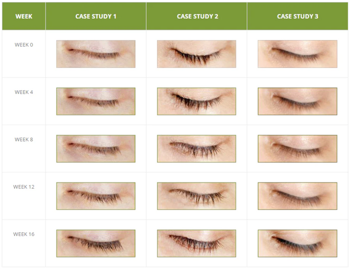 LashFood - Phyto-Medic Eyelash Enhancing Serum