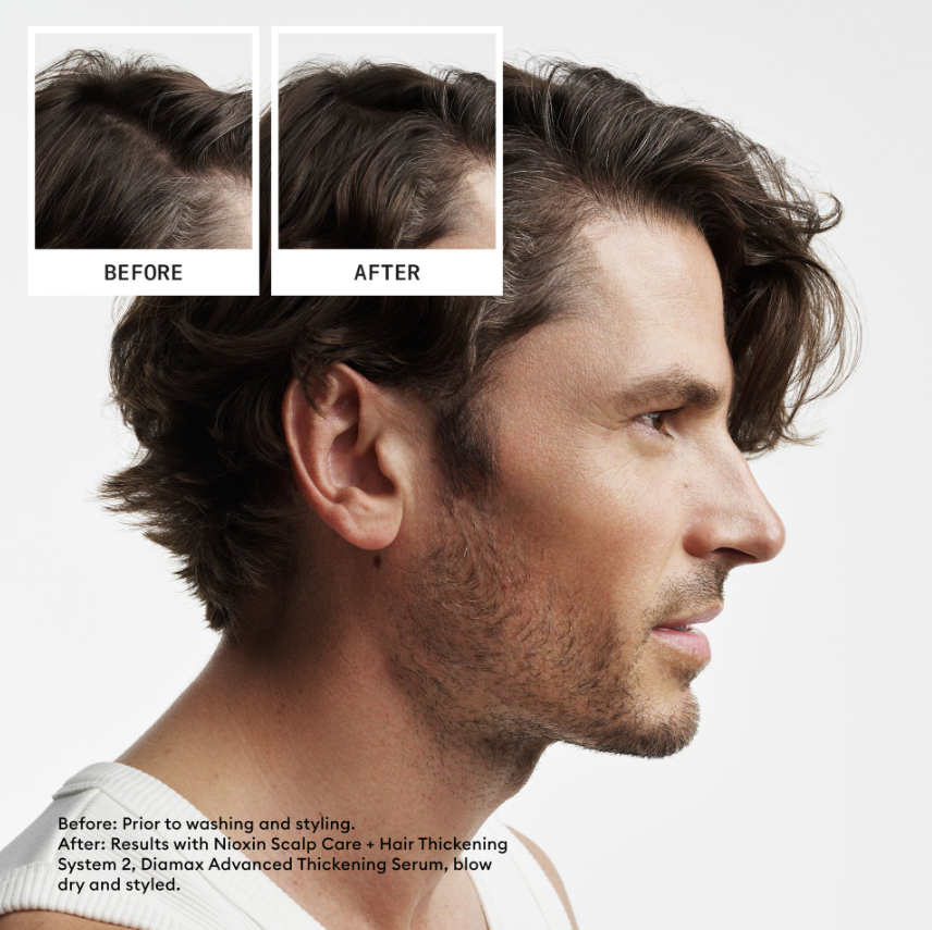 Nioxin System 2 Shampoo/Conditioner Kit - Natural Hair with Progressed Thinning