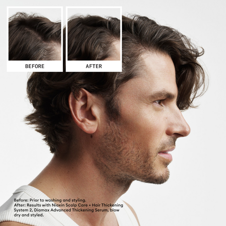 Nioxin System 2 Shampoo/Conditioner Kit - Natural Hair with Progressed Thinning