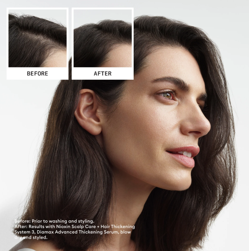 Nioxin 3 Kit - Shampoo, Conditioner and Treatment for Colored Hair Light Thinning